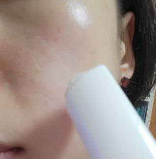 [트윙클라] 안티멜라 수딩 워터밤+안티링클 샤이닝 멀티밤 — 5점을 준 리뷰어가 2022년 8월 올린 사용 사진