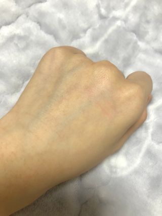 히루스카 포스트아크네 클리어 — 3.5점을 준 리뷰어가 2021년 1월 올린 사용 사진