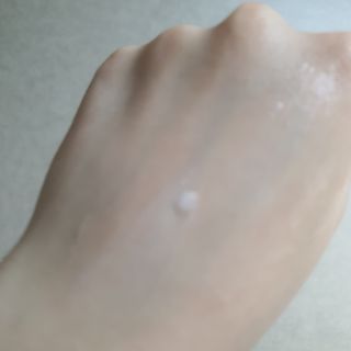 이엔코스 알부틴 알파 화이트닝크림 — 5점을 준 리뷰어가 2021년 4월 올린 사용 사진