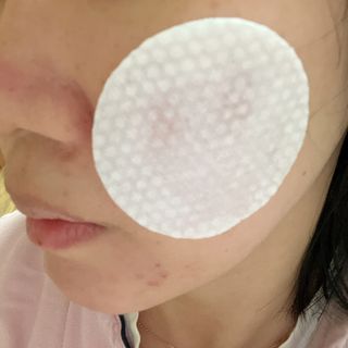 오투에니원 화이트 스완 갈락토미세스 비타민 C 필링 패드 60매 — 5점을 준 리뷰어가 2023년 2월 올린 사용 사진