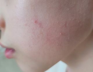브에노 스킨셀 더마 앰플 — 4점을 준 리뷰어가 2021년 6월 올린 사용 사진