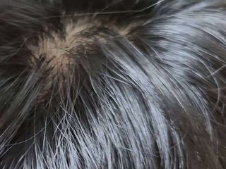 모두발라 탈모집중케어 헤어토닉 — 5점을 준 리뷰어가 2021년 12월 올린 사용 사진