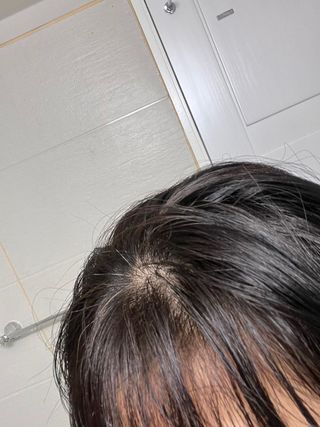 (주)닥터오레고닌 닥터오레고닌 탁시폴린 에디션 트리트먼트 — 5점을 준 리뷰어가 2023년 8월 올린 사용 사진