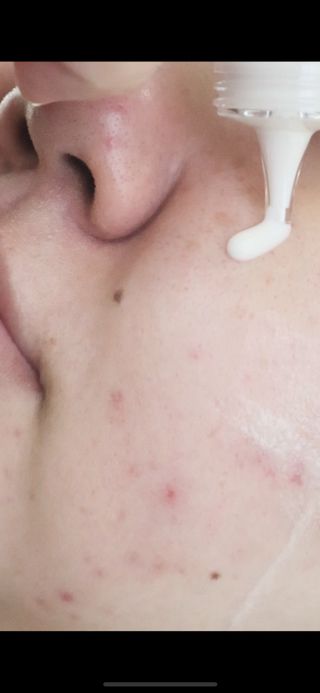 📷프리 (인스타체험단) [밀리밀리] 메디 앰플 비타 15ml — 5점을 준 리뷰어가 2025년 9월 올린 사용 사진