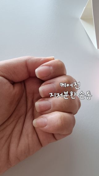 젤리핏 피치리페어 10ml 피치 컬러영양제 효과있는 손톱강화제 — 5점을 준 리뷰어가 2022년 7월 올린 사용 사진