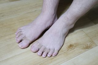 휜 발가락이 아프다면..발가락 스트레칭 보조용품 쿨핀 두발애(1set-2개입) — 5점을 준 리뷰어가 2022년 6월 올린 사용 사진