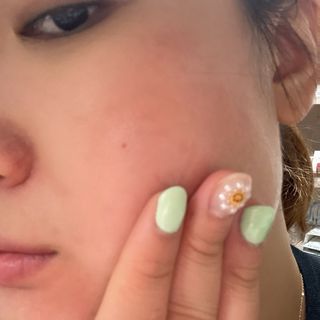 냉장고에 넣어요, 붉은 트러블 피부 다음날 진정되요 [버진팜스 푸딩수딩아토] — 5점을 준 리뷰어가 2021년 9월 올린 사용 사진