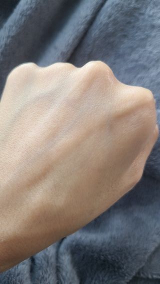 젠바이오 코스메틱스 젠바이오수딩크림]   가려운 피부 & 아토피 원픽 크림 — 5점을 준 리뷰어가 2022년 9월 올린 사용 사진