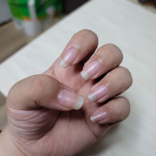 뷰젤 매직케어 네일솔루션 손발톱 보습 영양제 펜슬타입 5ml — 4점을 준 리뷰어가 2022년 3월 올린 사용 사진