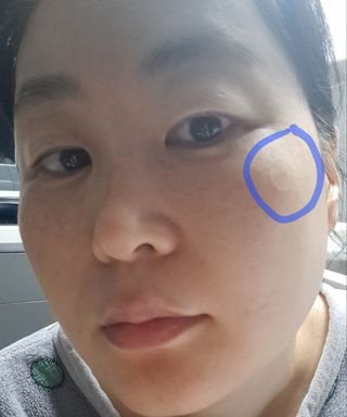 세뚜아(Cettua) 세뚜아 스팟 클리어 듀얼 패치 Cettua Spot Clear Dual Patch — 5점을 준 리뷰어가 2023년 11월 올린 사용 사진