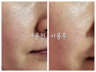 더메디코템 일루미네이팅 오로라 에멀젼마스크 — 5점을 준 리뷰어가 2025년 6월 올린 사용 사진
