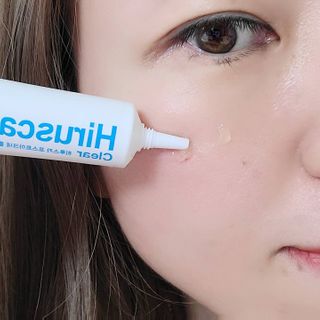 히루스카 포스트아크네 클리어 — 5점을 준 리뷰어가 2021년 3월 올린 사용 사진
