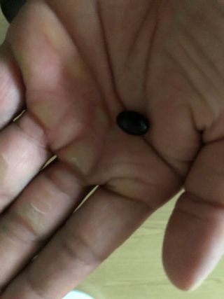 네이처셋 루테인 아스타잔틴 캡슐 1개월분 — 5점을 준 리뷰어가 2021년 7월 올린 사용 사진