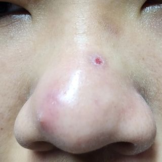 세뚜아(Cettua) 세뚜아 스티키 포어 패치 Cettua Sticky Pore Patch — 4점을 준 리뷰어가 2023년 10월 올린 사용 사진