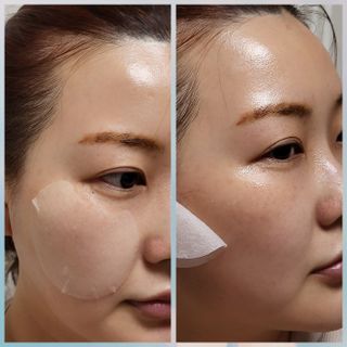 리더스코스메틱 리더스 카밍 바이오틱스 퀵 수딩 패드 — 5점을 준 리뷰어가 2022년 4월 올린 사용 사진