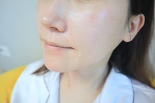 트윙클라 안티멜라 수딩 워터밤 — 5점을 준 리뷰어가 2022년 6월 올린 사용 사진