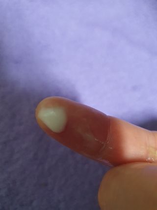 산수시 데포 세럼 수분 물광 비타민 에센스 50ml 기초화장품 — 5점을 준 리뷰어가 2021년 7월 올린 사용 사진