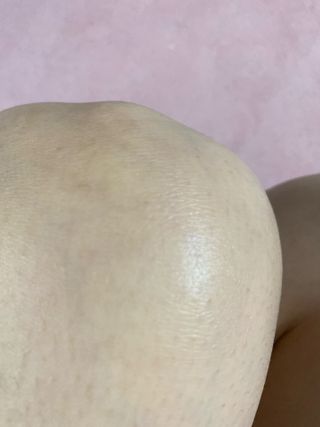 하이브리온 [쿠팡]멜라제로 시카엑소좀 크림 50ml PDRN 줄기세포 주름 미백기능성 피부과 병원입점, 1개, 50g — 5점을 준 리뷰어가 2025년 7월 올린 사용 사진