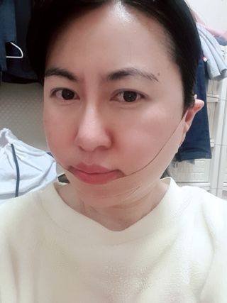 아이디플라코스메틱 아이디 페이스핏 마이너스 밴드 v2 — 5점을 준 리뷰어가 2021년 6월 올린 사용 사진