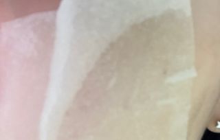 [후르디아] 화난피부 급속진정 AC 클리어 패드 (개별포장 50매) — 5점을 준 리뷰어가 2024년 4월 올린 사용 사진