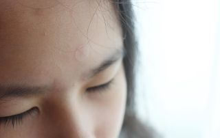 세뚜아(Cettua) 세뚜아 스팟 클리어 듀얼 패치 Cettua Spot Clear Dual Patch — 5점을 준 리뷰어가 2023년 9월 올린 사용 사진