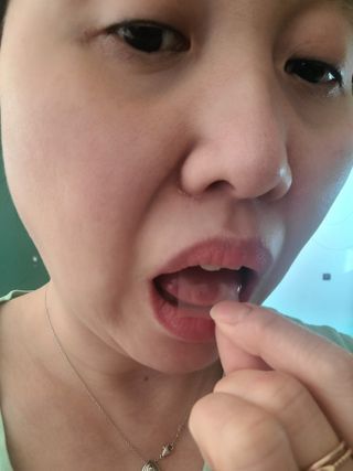 메디포스트 모비타 글루타치온 이지 필름형 30매 — 5점을 준 리뷰어가 2022년 12월 올린 사용 사진