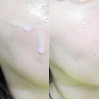 리더스코스메틱 리더스 카밍 바이오틱스 에센스 워터 — 5점을 준 리뷰어가 2021년 10월 올린 사용 사진