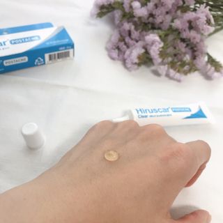 히루스카 포스트아크네 클리어 — 3.5점을 준 리뷰어가 2021년 1월 올린 사용 사진