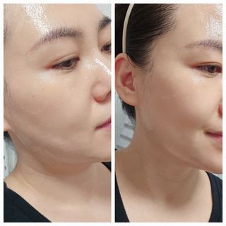 리엔케이 인텐스 브라이트닝 세럼 시트 마스크 — 5점을 준 리뷰어가 2023년 9월 올린 사용 사진