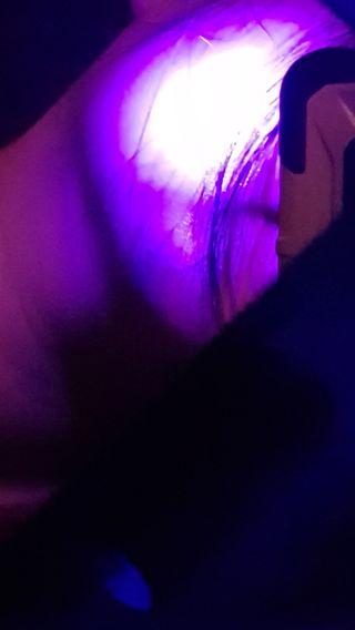 메데스 비츠케어 모공케어 피부관리키트 — 5점을 준 리뷰어가 2021년 7월 올린 사용 사진