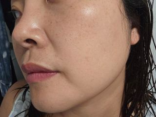 하이브리온 [쿠팡]멜라제로 시카엑소좀 크림 50ml PDRN 줄기세포 주름 미백기능성 피부과 병원입점, 1개, 50g — 5점을 준 리뷰어가 2025년 7월 올린 사용 사진