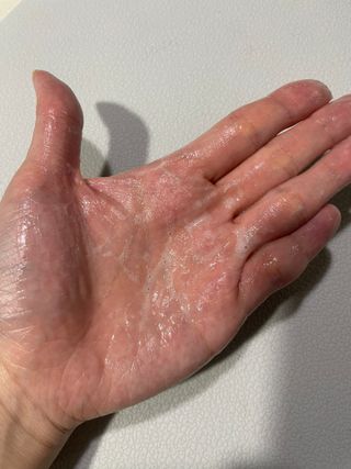 MF프리 [닥터문] 유산균 락토케어 질경초 여성청결제 200ml (폼타입) — 5점을 준 리뷰어가 2022년 7월 올린 사용 사진