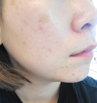 체르엠  프루브 콜라겐 앰플세럼 60ml 1병 — 5점을 준 리뷰어가 2021년 9월 올린 사용 사진