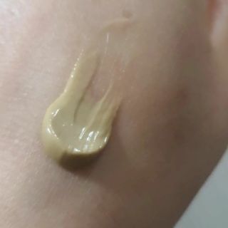 건선/아토/습진/민감성 피부 천연보습진정크림 소리온 크림 & 센시티브 크림 50g — 5점을 준 리뷰어가 2022년 1월 올린 사용 사진