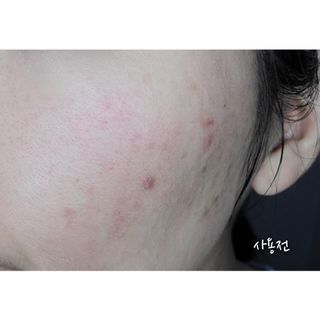 [녹산] 비건 대나무 밸런싱 수분 토너 + 비건 바이오 비타 에센스 — 3점을 준 리뷰어가 2022년 10월 올린 사용 사진