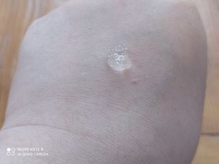 레드투래드 센서티브 어메이징 앰플 30ml — 5점을 준 리뷰어가 2021년 7월 올린 사용 사진
