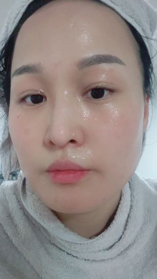 리더스코스메틱 리더스 퍼스트 샷 액티브 에센스 에이지 컨트롤 — 4점을 준 리뷰어가 2021년 11월 올린 사용 사진