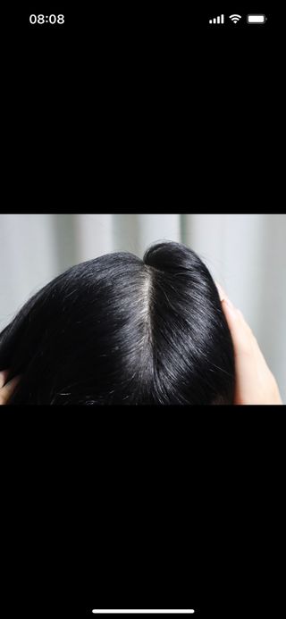딸로 맥주효모 두피스케일러 / 각질&노폐물 타파 두피 딥-클렌징 — 5점을 준 리뷰어가 2023년 7월 올린 사용 사진