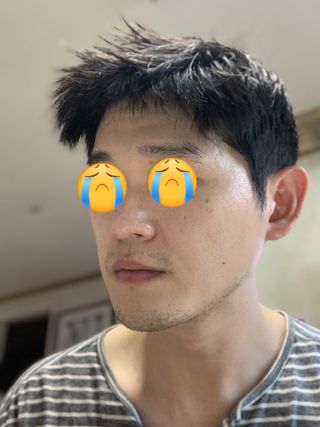 브에노 스킨셀 더마 앰플 — 3점을 준 리뷰어가 2021년 7월 올린 사용 사진