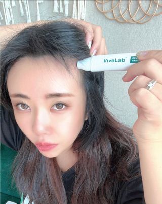바이브랩 [탈모증상완화] 헤어라인 눈썹 두피앰플 — 5점을 준 리뷰어가 2022년 1월 올린 사용 사진