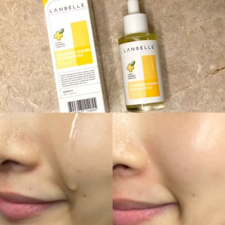 랑벨 비타 에너지 잡티 앰플 50ml 고농축 비타민, 저자극, 수분 촉촉, 미백 앰플 — 5점을 준 리뷰어가 2022년 4월 올린 사용 사진