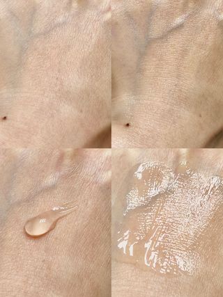 작심연구소 바르는 피부과 레이저 메디스팟크림 플러스 — 5점을 준 리뷰어가 2022년 6월 올린 사용 사진