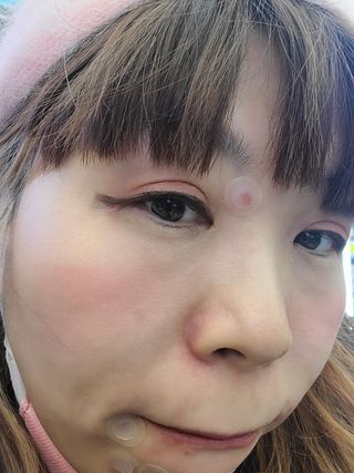 닥터플리너스 제트 큐어 크림 30ml + 제로 트러블 패치 9EA — 5점을 준 리뷰어가 2022년 3월 올린 사용 사진