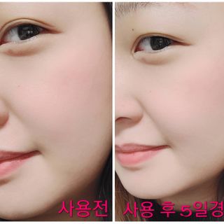 이엔코스 알부틴 알파 화이트닝크림 — 5점을 준 리뷰어가 2021년 2월 올린 사용 사진