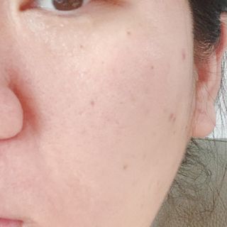 리더스코스메틱 리더스 카밍 바이오틱스 에센스 워터 — 5점을 준 리뷰어가 2022년 3월 올린 사용 사진