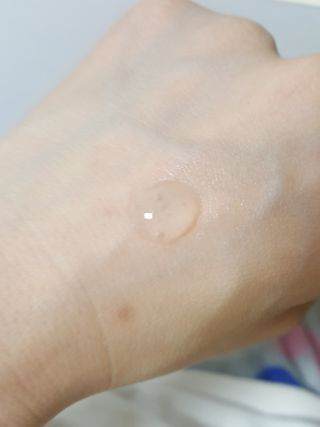 이엔코스 알부틴5프로화이트닝세럼 — 5점을 준 리뷰어가 2021년 2월 올린 사용 사진