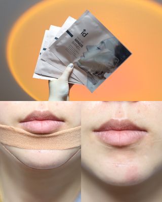 아이디플라코스메틱 아이디 페이스핏 마이너스 밴드 v2 — 5점을 준 리뷰어가 2021년 5월 올린 사용 사진