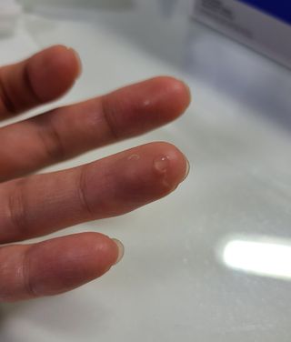 히루스카 포스트아크네 클리어 — 3점을 준 리뷰어가 2021년 3월 올린 사용 사진