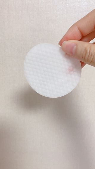 키노닉스 양배추 카밍 진정 토너패드 — 5점을 준 리뷰어가 2021년 7월 올린 사용 사진