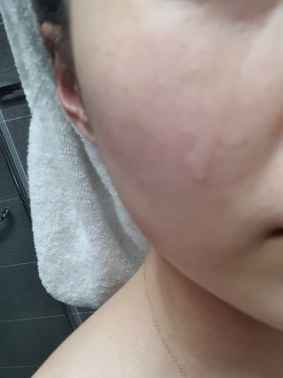나우 [리브엠] 화해 1등 진정 앰플, 엑소코어 카밍 텐션 앰플 — 4점을 준 리뷰어가 2023년 5월 올린 사용 사진